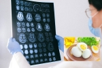 Eggs and Alzheimer’s for health, Eggs and Alzheimer’s study, eggs may help prevent alzheimer s study, Diet