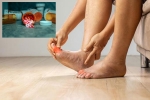 Gout Drugs updates, Gout Drugs on heart stroke, gout drugs may cut the risk of heart attack, Episode