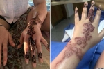 allergic reaction to henna hair dye, fashion and beauty, henna tattoo cause aussie woman to almost lose her hand, Aswan