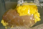 Universal Kidney latest, Universal Kidney Scientists, scientists develop universal kidney transplanted to any blood group, Rti