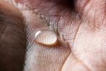 Solution for Sweaty Hands And Feet, 10 Ways To Treat Sweaty Hands And Feet, 10 ways to treat sweaty hands and feet, Vodka