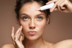 face diagnosis, face telling about health, what your face is telling you about your health, Dark circles