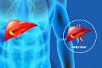 Fatty Liver Disease News body organs, Fatty Liver Disease News body organs, body organs that can be affected by fatty liver disease, Excessive drinking