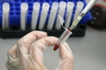 New Human Antibodies To Combat Ebola, Ebola Virus, new human antibodies to combat ebola, Sudan virus