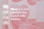 mpox break down, health emergency, mpox emergency again, Sweden