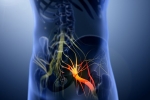 causes of Sciatica, Sciatica issues, help yourself on sciatica, Back pain